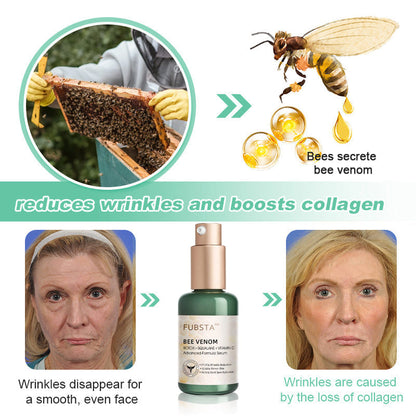 FDA Approved✨𝓕𝓾𝓫𝓼𝓽𝓪™ Botox Bee Venom Wrinkle Removal Serum-Last Day Promotion 75% OFF👩‍⚕️✨