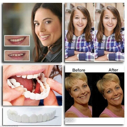Last Day Discount - 80% Off 😁Newest 2025👨‍⚕Adjustable Snap-On Dentures💝