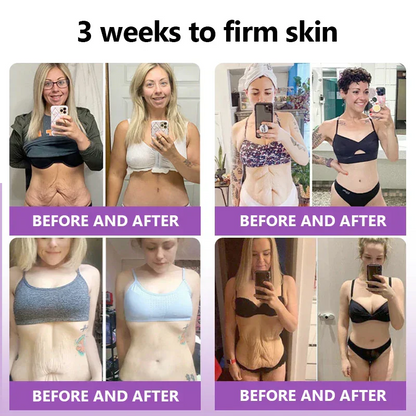 [OFFICIAL STORE] Fubsta® Skin Firming Tighten Lift Reducing Body Cream – Restore Elasticity & Achieve Youthful, Glowing Skin! ✨🌺