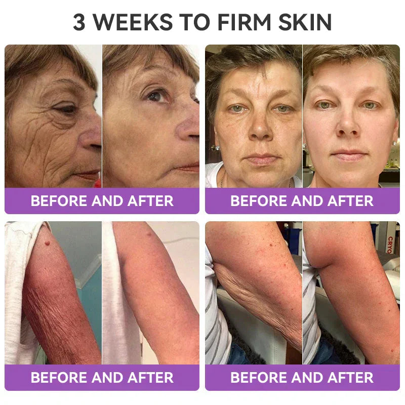 [OFFICIAL STORE] Fubsta® Skin Firming Tighten Lift Reducing Body Cream – Restore Elasticity & Achieve Youthful, Glowing Skin! ✨🌺