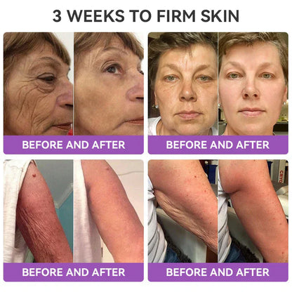 [OFFICIAL STORE] Fubsta® Skin Firming Tighten Lift Reducing Body Cream – Restore Elasticity & Achieve Youthful, Glowing Skin! ✨🌺