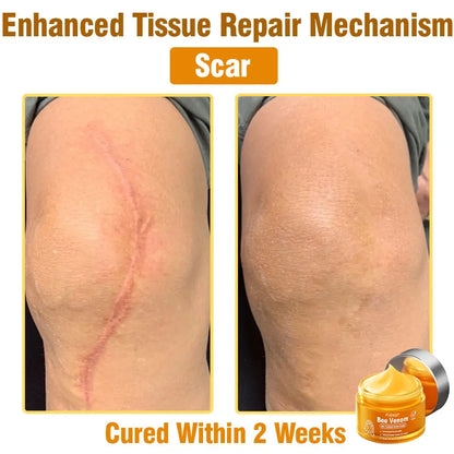 Fubsta® 𝑩𝒆𝒆 𝑽𝒆𝒏𝒐𝒎 𝑺𝒌𝒊𝒏 𝑻𝒓𝒆𝒂𝒕𝒎𝒆𝒏𝒕 𝑺𝒆𝒓𝒖𝒎 𝑪𝒓𝒆𝒂𝒎👨‍⚕️ (Suitable for all ages & TGA recommends)