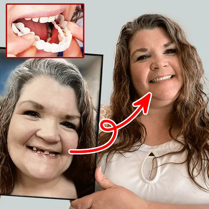 Last Day Discount - 80% Off 💝Newest 2025👨‍⚕Adjustable Snap-On Dentures😁