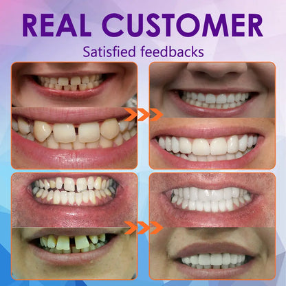 𝐁𝐢𝐤𝐞𝐧𝐝𝐚™ 𝐒𝐢𝐥𝐢𝐜𝐨𝐧𝐞 𝐑𝐞𝐥𝐢𝐧𝐞 𝐃𝐞𝐧𝐭𝐮𝐫𝐞 𝐒𝐞𝐭 (⏰ 𝐋𝐢𝐦𝐢𝐭𝐞𝐝 𝐓𝐢𝐦𝐞 𝐃𝐢𝐬𝐜𝐨𝐮𝐧𝐭 𝐋𝐚𝐬𝐭 𝟒𝟎 𝐌𝐢𝐧𝐮𝐭𝐞𝐬 ⏰) 🦷✨ - Health Canada Certified✅