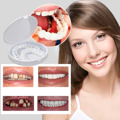 Last Day Discount - 80% Off - Newest 2025 - Adjustable Denture with Snap Dentures