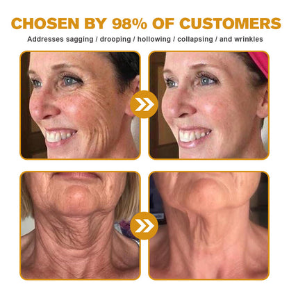 New Year Special Offer🎊- ✅ 𝙵𝚞𝚋𝚜𝚝𝚊® Botox Bee Venom Wrinkle Removal Cream-Last Day Promotion 75% OFF