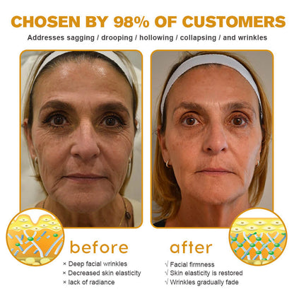 New Year Special Offer🎊- ✅ 𝙵𝚞𝚋𝚜𝚝𝚊® Botox Bee Venom Wrinkle Removal Cream-Last Day Promotion 75% OFF