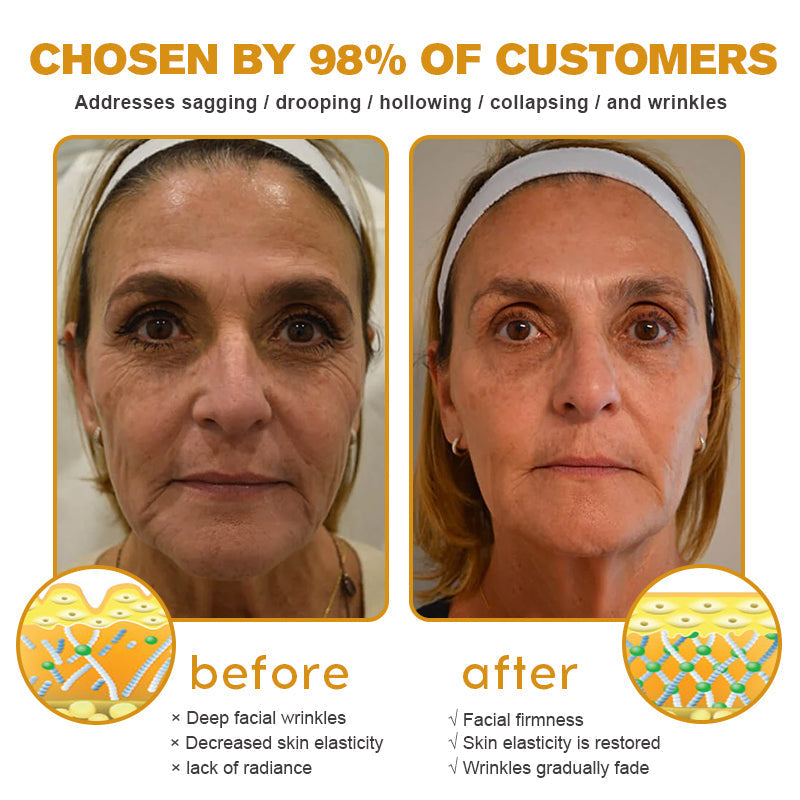 Made and Shipped from the USA✅ Fubsta™ Botox Bee Venom Wrinkle Removal Cream-Last Day Promotion 70% OFF