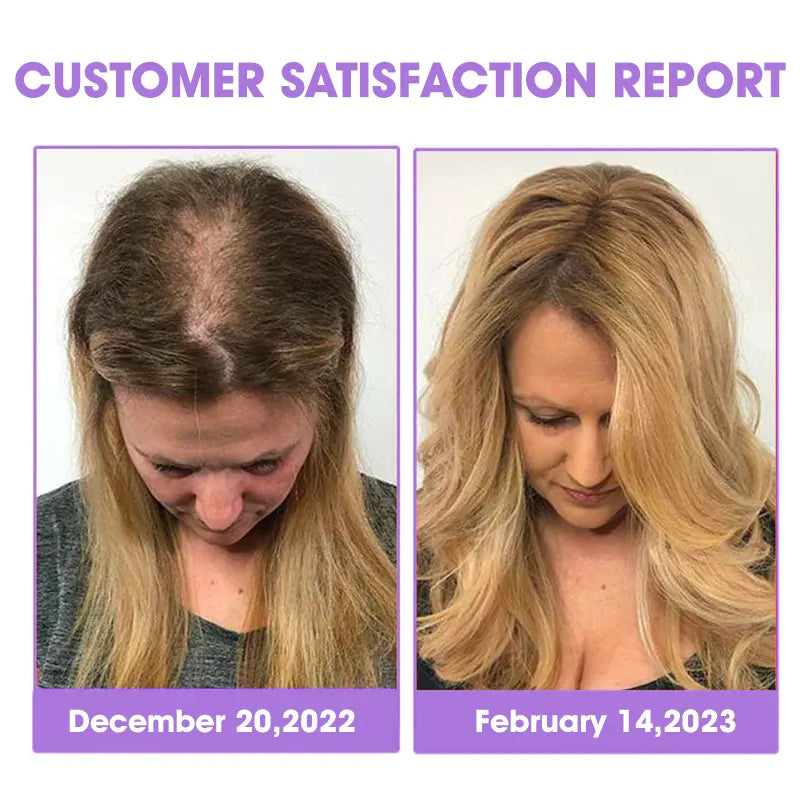 DEEVOO® ✨👩‍🔬 Hair Root Repair Growth Drops – Achieve Thicker Hair Fast⚡