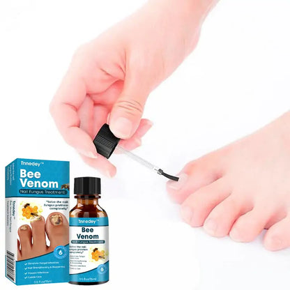 𝐓𝐧𝐧𝐞𝐝𝐞𝐲® Bee Venom Toenail Fungus Treatment Solution🐝💅 - Say Goodbye to Nail Fungus✨