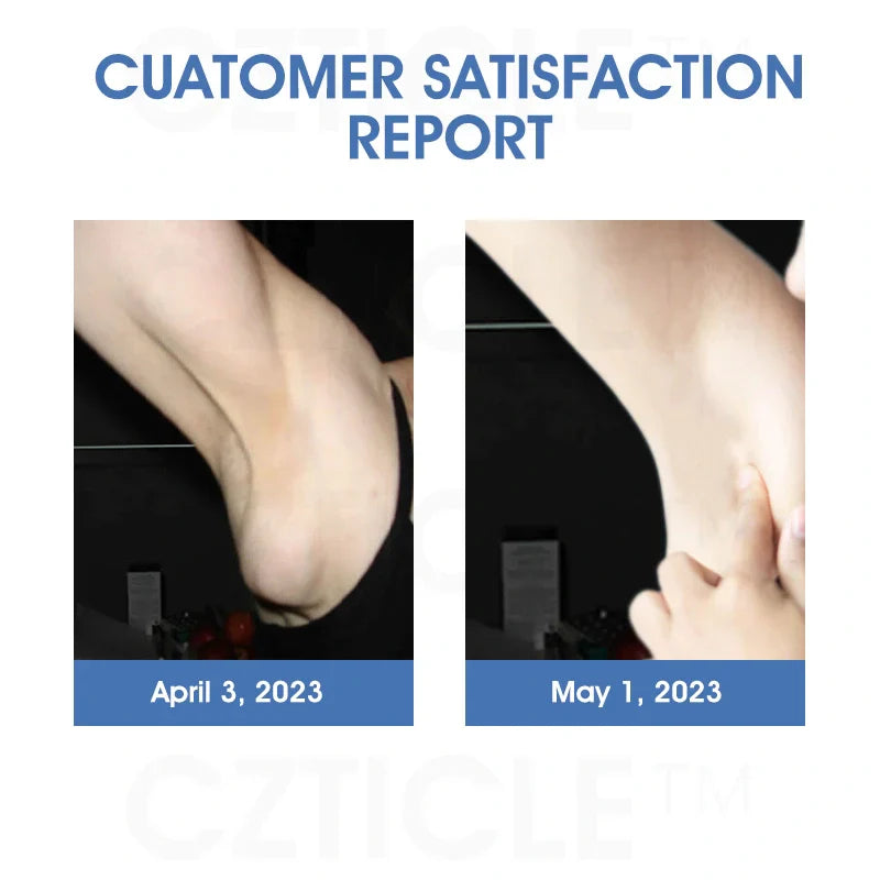 CZTICLE™ Titanium Ion Lymphatic Drainage Watch