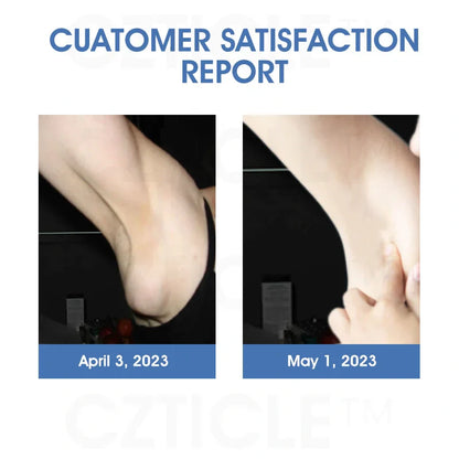 CZTICLE™ Titanium Ion Lymphatic Drainage Watch